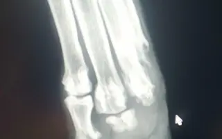 POMOC PRO FOXÍČKA - ZDRAVÝ DECH A PROTÉZA