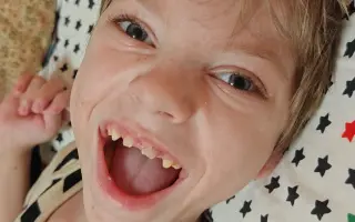 Pomozme bojovníkovi Michálkovi vykročit k prvnímu krůčku a lepší budoucnosti