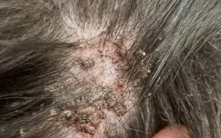 Zachraňme společně nemocného Badýska