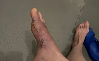 Naděje pro Karolinu (od Martina)