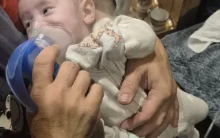 Pomoc pro Emičku s cystickou fibrózou