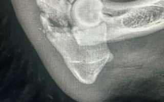 Brdy ji schovaly, lidé ji našli - pomozme fence Týnce uzdravit tlapku 🐾