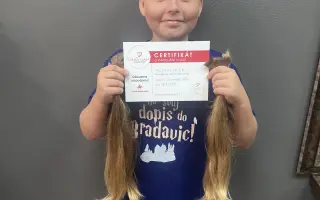 Šance pro Tondu na zotavení po vážných popáleninách