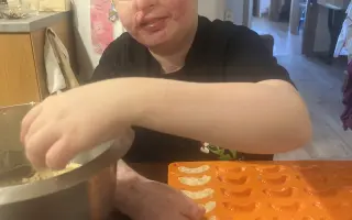 Šance pro Tondu na zotavení po vážných popáleninách