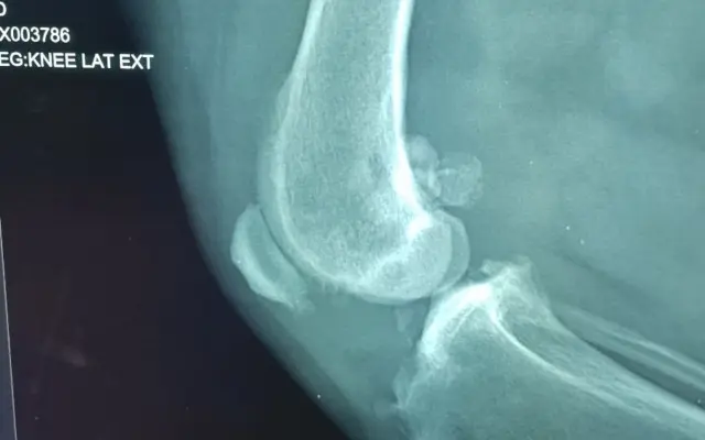 Sbírka na nový/bazarový automobil pro vážně nemocného, invalidního muže