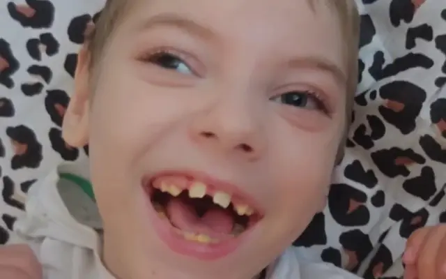 Pomozme bojovníkovi Michálkovi vykročit k prvnímu krůčku a lepší budoucnosti