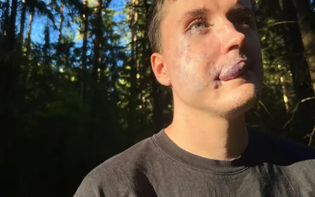 Pomozme Lukášovi zvládnout léčbu v zahraničí