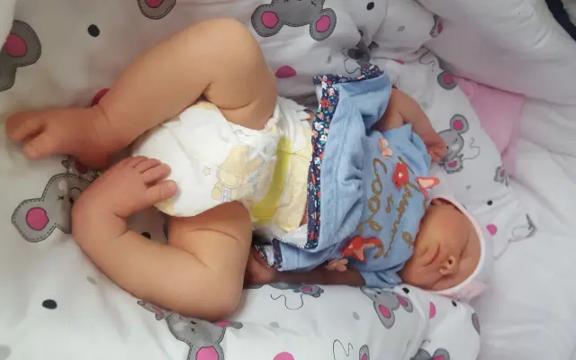 Klaudinka potřebuje operaci, aby mohla běhat bez bolesti