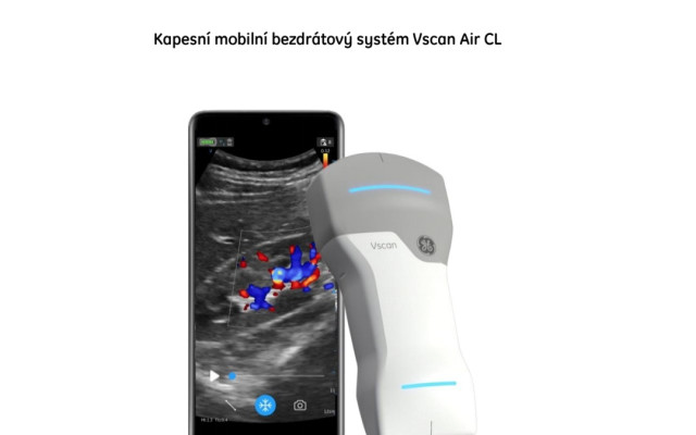 Přenosný ultrazvuk pro mobilní HOSPIC sv.Mikuláše