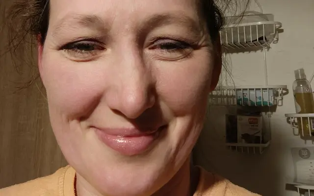 Pomozte Janě k novému úsměvu